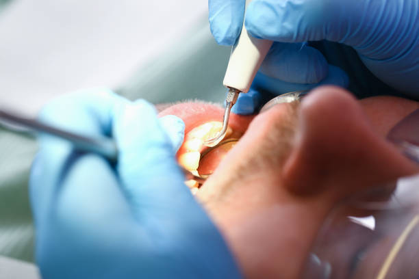 Best Emergency Treatment for Oral Infections in Arrowhead Beach, NC