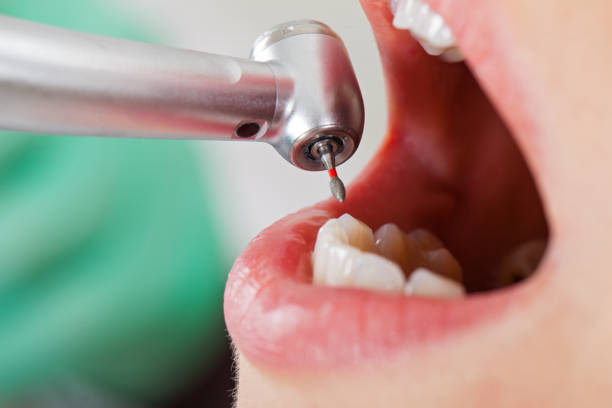 Best Emergency Care for Gum Disease in Arrowhead Beach, NC